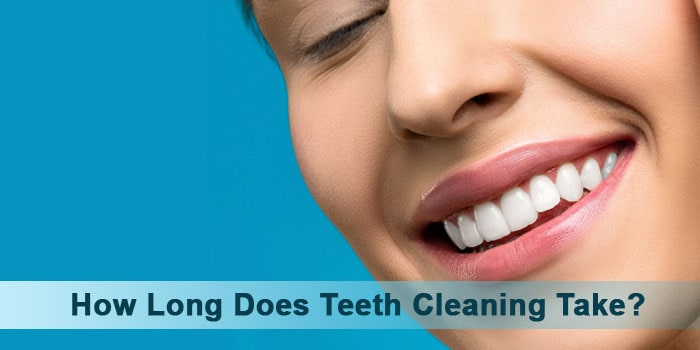 How long does teeth cleaning take