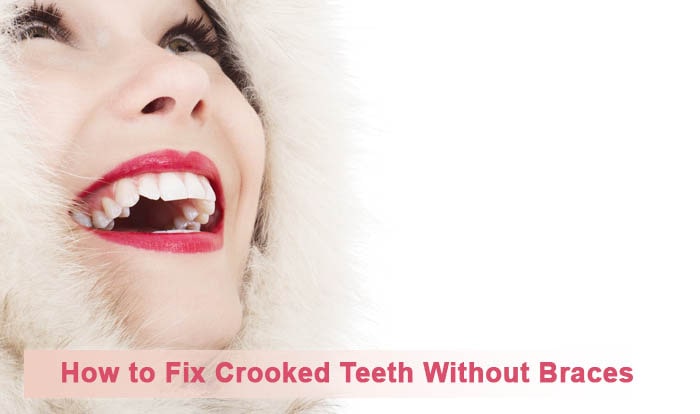 how to fix crooked teeth without braces