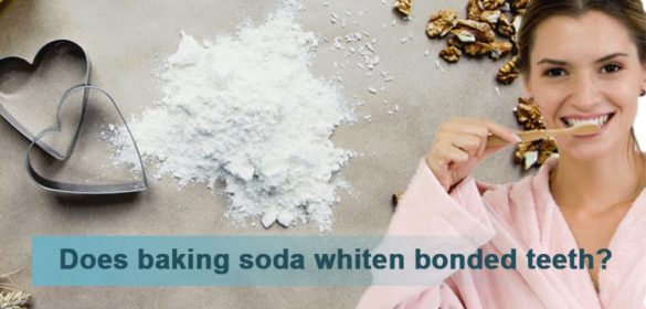 How to Whiten Bonded Teeth at Home Life Cycle Blog