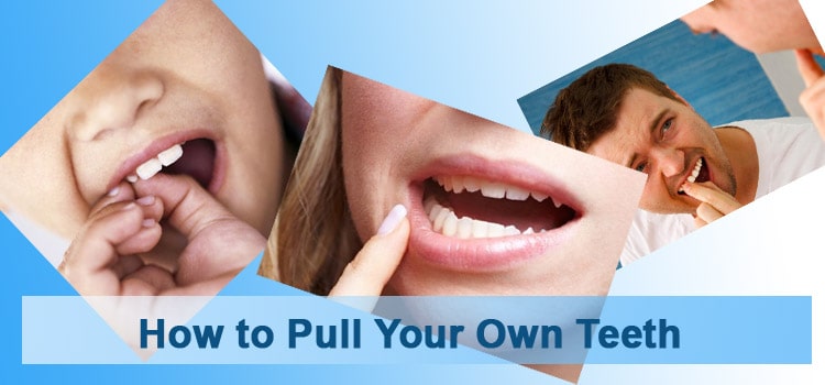 How to Pull Your Own Teeth
